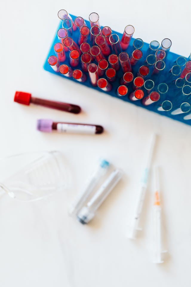 DHEAS Blood Test